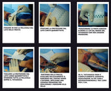 DERMALIZE PELICULA 5pcs